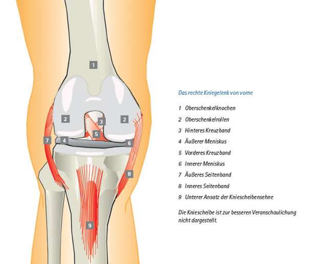künstliches kniegelenk